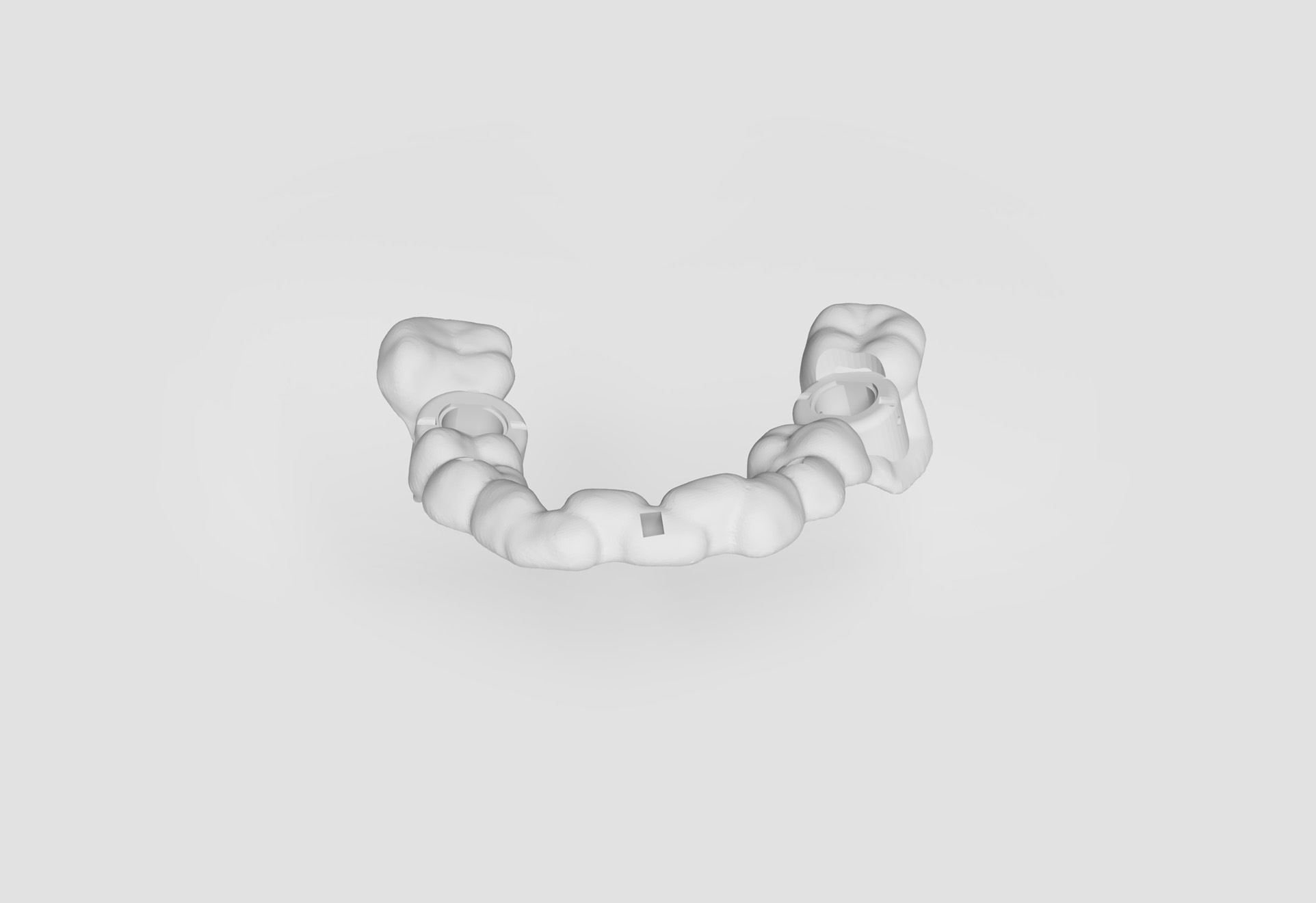 Dentalplanung